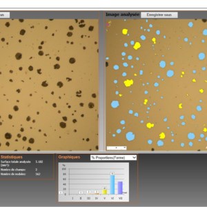 Analyse de nodules selon la norme ISO945