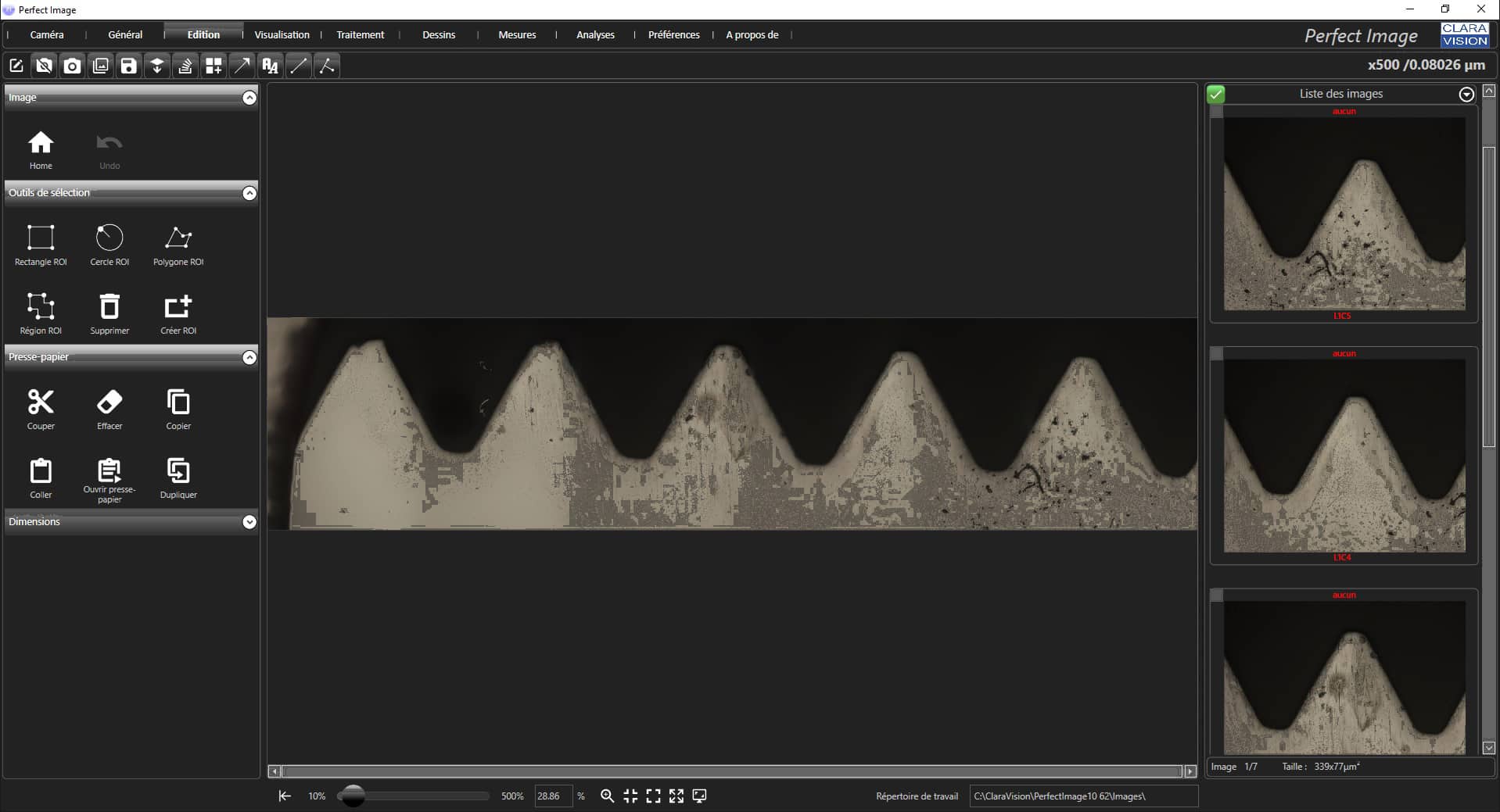 Reconstruction d'images panoramiques en microscopie 